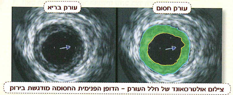 (בספר תמונה:) מודדים קצב לב בעזרת חיישן.